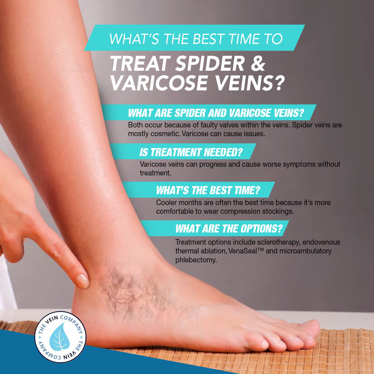 Best time to treat spider & varicose veins