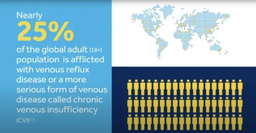 Venous Reflux Disease – Overview