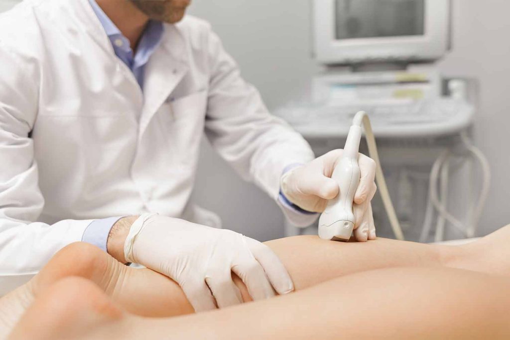 Spider Veins Laser Treatment Risks