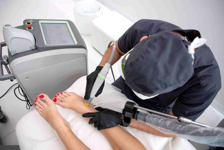 laser treatments for spider varicose vein hurt